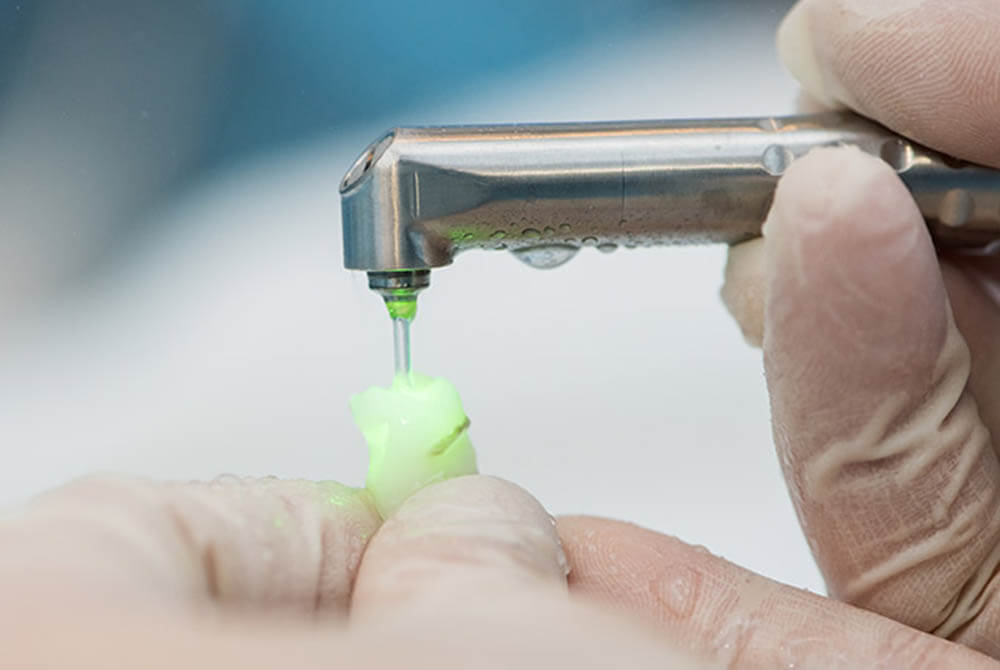 Laser Dentistry